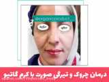 تیرگی پوست صورت