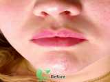 نمونه کار ژل لب روسی