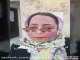 نتیجه عالی تزریق چربی از بدن به صورت
