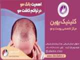 فیلم شستشوی سر بعد از کاشت مو
