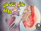 سرطان روده و علائم و نشانه های آن