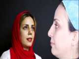 عمل بینی و چانه