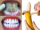 روش های سفید کردن دندان از زبان دکتر عمرانی