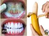 بهترین روش سفید کردن دندان | سفید کردن دندان در خانه بسیار ساده
