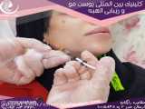 تنها دستگاه عضله ساز در تهران