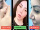 مشاوره رایگان ایمپلنت در کرج
