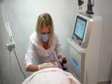 قیمت فروش دستگاه matrix co2 fractional laser