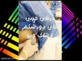 نحوه خارج کردن معده برداشته شده در عمل اسلیو گاسترکتومی از شکم