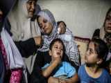 هر روز ده کودک فلسطینی قطع عضو می‌شوند!