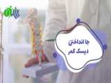 نکته های در مورد فتق دیسک کمر