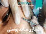 مرکز پاکسازی پوست دلیکا