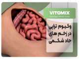 کلینیک تخصصی زخم دادفر.شیرازپلاسما تراپی زخم