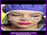 لابیاپلاستی در شیراز