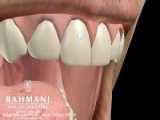 علت نامرتب بودن دندان ها