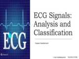 استخراج ویژگی از سیگنال ECG