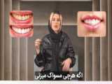 سفید کننده دندان 5040