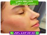 بهترین دکتر بوتاکس در تهران