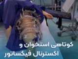 اکسترنال فیکساتور (External fixator) آذین طب سلامت