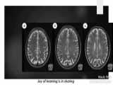 تصویربرداری مغزی(Brain CT-scan and MRI)- دکتر لیلا کمال زاده