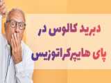 جعبه گشایی مینی ماساژور تفنگی شیائومی- کاوشگران فنون جیران