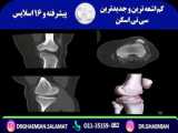 تست ریمل بلند کننده سه بعدی گابرینی