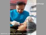 توضیحات کامل درباره ساکشن غبغب
