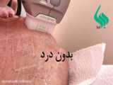 کاشت مو پر تراكم تغییرات فوق‌العاده