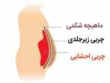 هرگز اینجوری حرکت کرانچ شکم را انجام ندهید | 10 اشتباه رایج در کرانچ شکم