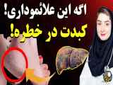 ۱۰ نشانه اولیه غیرعادی که نشان می دهد کبد شما در حال فساد است