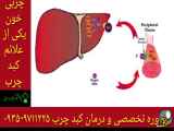 درمان قطعی چربی خون و کبد با شماره ۰۹۳۵۹۷۱۱۲۲۵