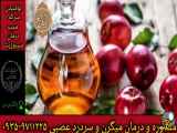 درمان سینوزیت، میگرن و سردردهای عصبی با سرکه سیب