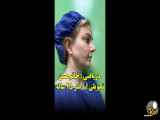 جراحی لیفت صورت و گردن برای یک دختر 25 ساله انجام دادیم