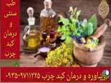 پاکسازی و درمان چربی سرشار در طب سنتی ۰۹۳۵۹۷۱۱۲۲۵