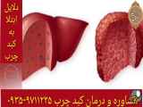راهکارهای درمان و تطهیر کبد چرب و عوامل خطر وقوع آن ۰۹۳۵۹۷۱۱۲۲۵