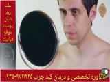 چربی در هپاتایت درمان و رنگ پوست زرد