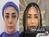 وقتی با گریه به کلینیک زیبایی ماه زر آمد