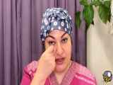 کاهش تیرگی زیر چشم