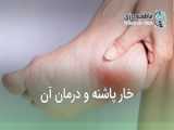خارها در ناحیه پاشنه