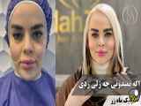 خطرات تزریق ژل های غیرمعتبر ( کلینیک زیبایی ماه زر )