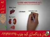 آنزیم کبدی AlT درمان و پاکسازی کبدچرب با شماره ۰۹۳۵۹۷۱۱۲۲۵