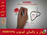 آزمایش بیلیروبین برای درمان و پاکسازی کبدچرب