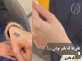 رفع تاتوی اسم «علی» با استفاده از روش‌های حرفه‌ای ( کلینیک زیبایی ماه زر )