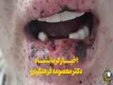 قتل خانواده‌ای در کرمانشاه ۵ نفر را کشته کرد!
