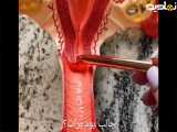 آموزش آناتومی دستگاه تناسلی زنانه _ آشنایی با اجزای رحم تخمدان