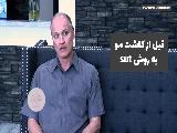 فیلم کاشت مو به روش sut