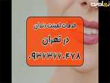لمینت دندان تضمینی تهران 09363660478 | مرکز لمینت دندان تهران