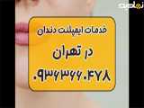 خدمات ایمپلنت دندان در سعادت آباد تهران 09363660478 | جراحی ایمپلنت دندان تهران