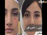 راز صورت صاف مامانم ( کلینیک زیبایی ماه زر )