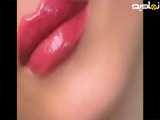 لیفت تاج لب متناسب با صورت...