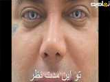 عمل تغییر دادن رنگ چشم